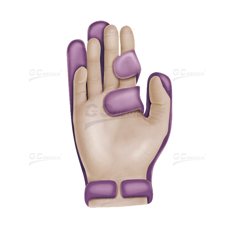 Surgical Hand Immobilizer